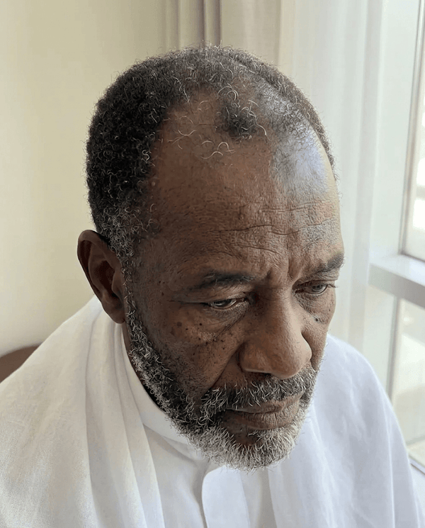 Gray Hair Problem