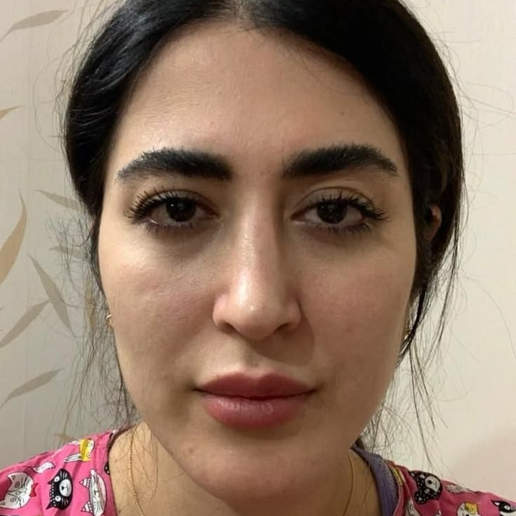 قبل استخدام جهاز نضارة برو — انتفاخات وهالات داكنة