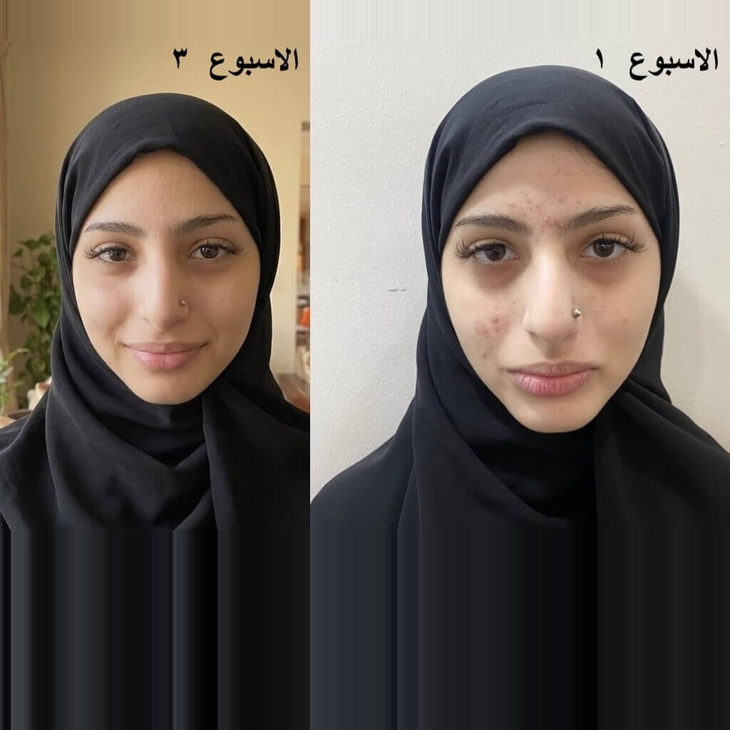 تقييم مريم الكعبي من دبي لجهاز نضارة برو